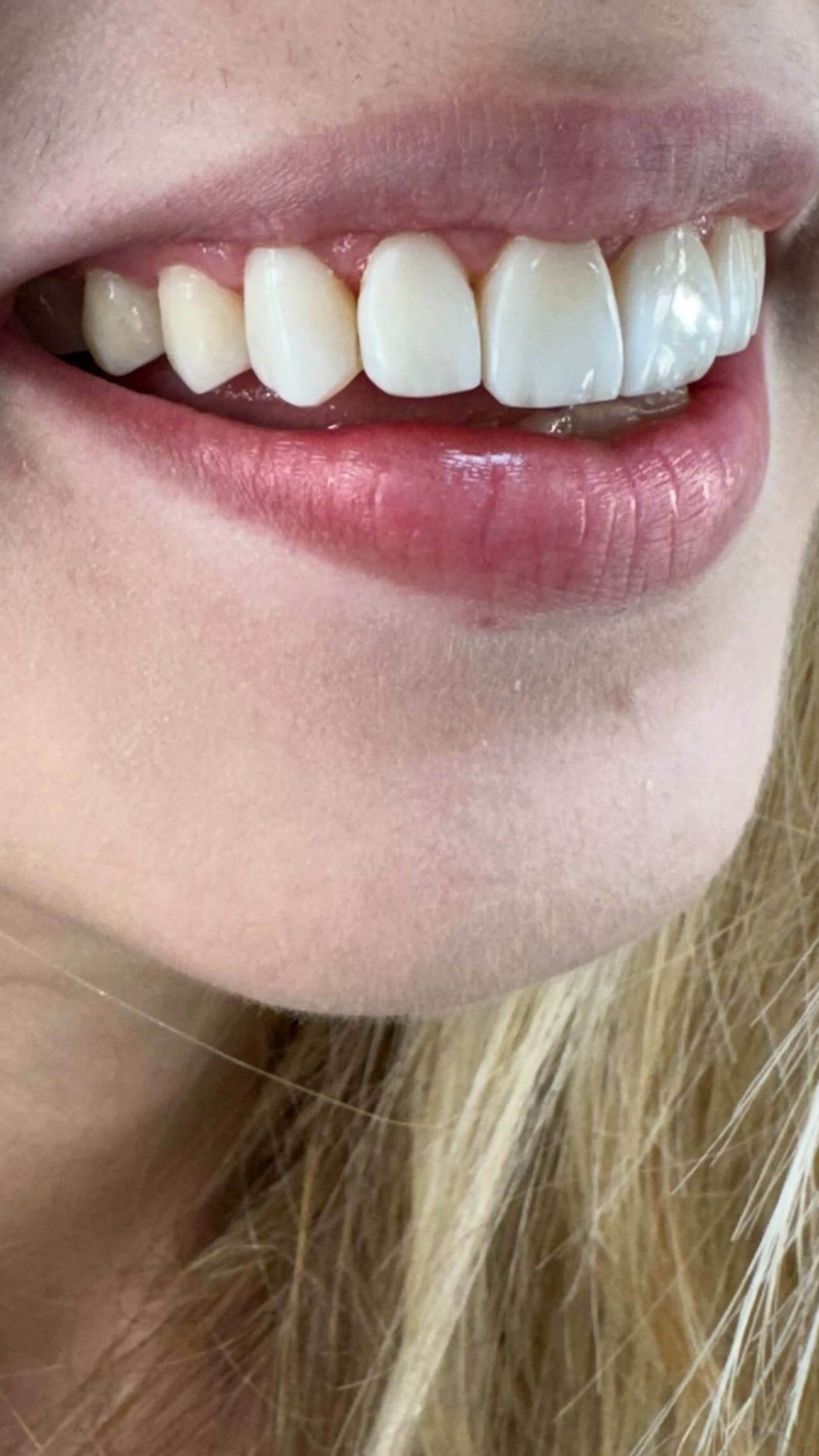 Quando o sorriso muda, a confiança muda